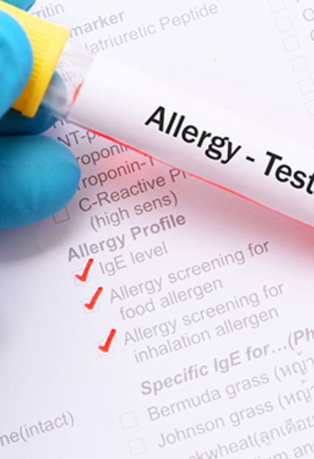 Allergy testing Stockbridge and Lawrenceville